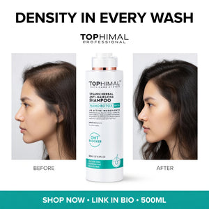 Best Shampoo for Thinning Hair in USA – Why Dmariyo is the Right Choice